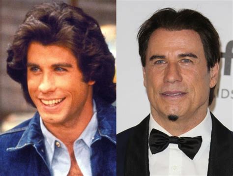 john travolta face lift|John Travolta Before and After Plastic Surgery